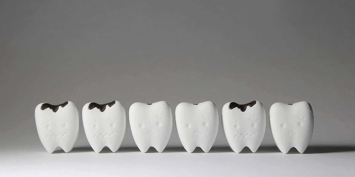 虫歯が進行する仕組み