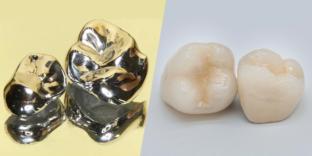 保険と自費の治療は何が違うのか？