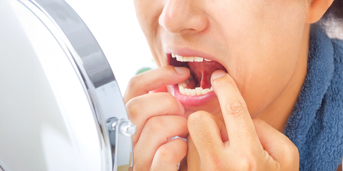 「どこに相談すればよいかわからない」症状こそ口腔内科へ