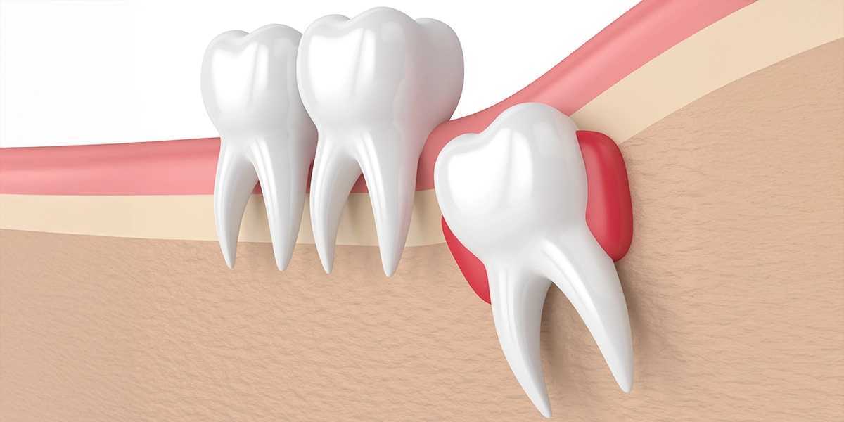 嚢胞(のうほう)