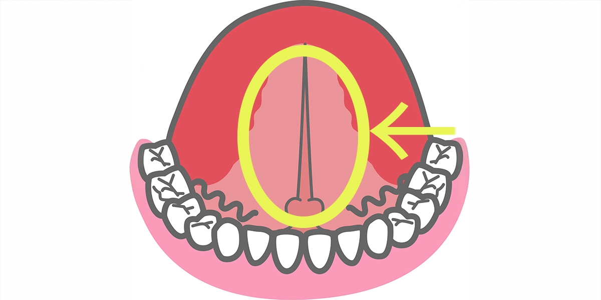 舌小帯(ぜつしょうたい)